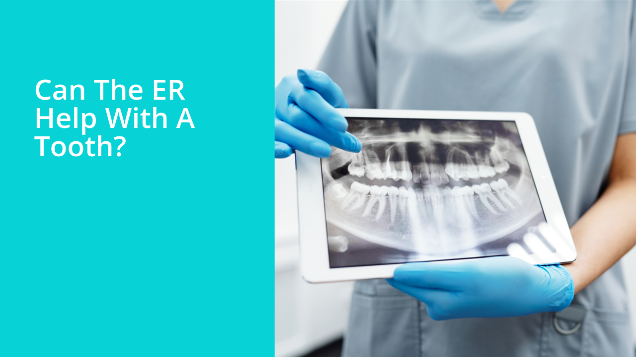 Can the ER help with a tooth?